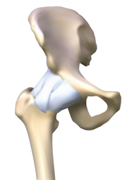 Figure 2. Hip joint with supporting ligaments