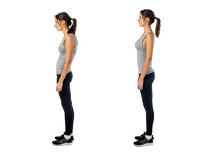 Woman with impaired posture position defect scoliosis and ideal bearing