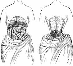 What Are the Health Risks Associated With Waist Training