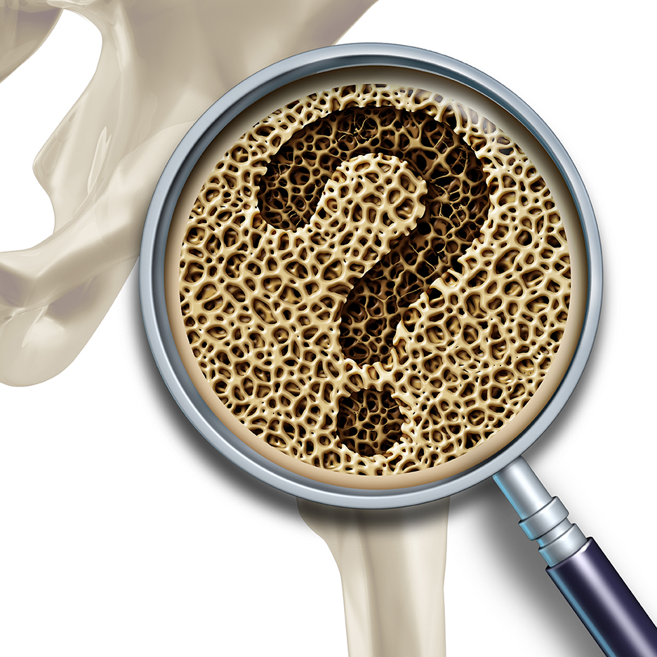 bone-health-question-osteoporosis