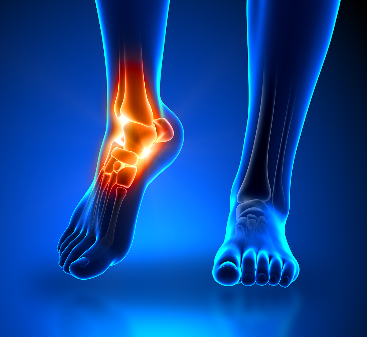 foot-pain-graphic