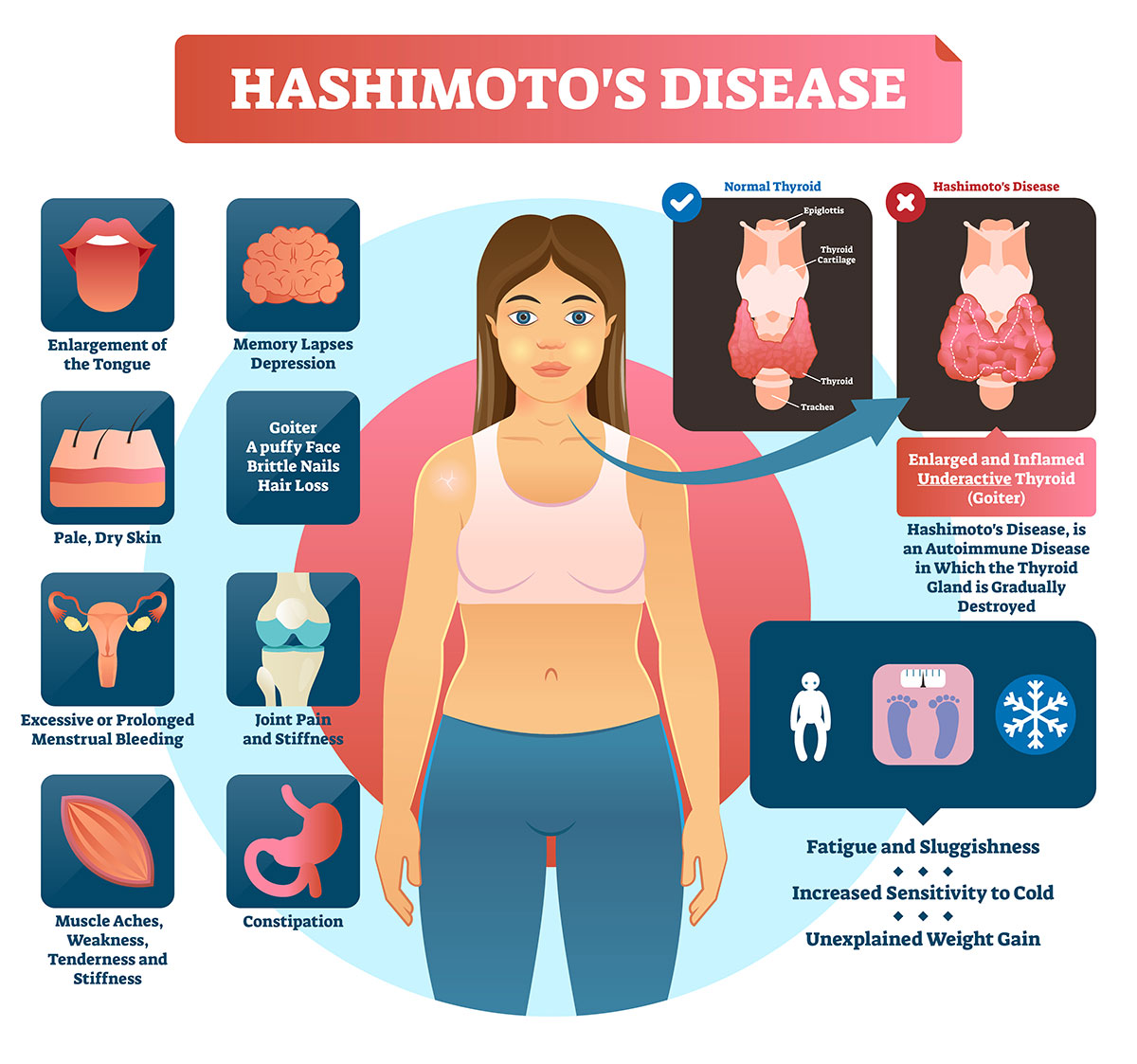 Hashimoto’s Disease: When the immune system turns against you ...